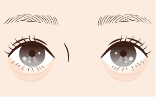 目袋が際立つ目元