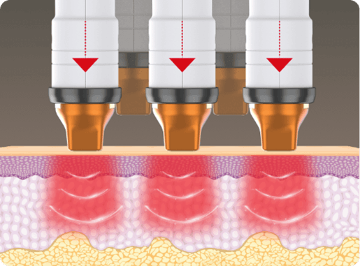 moneの肌への効果